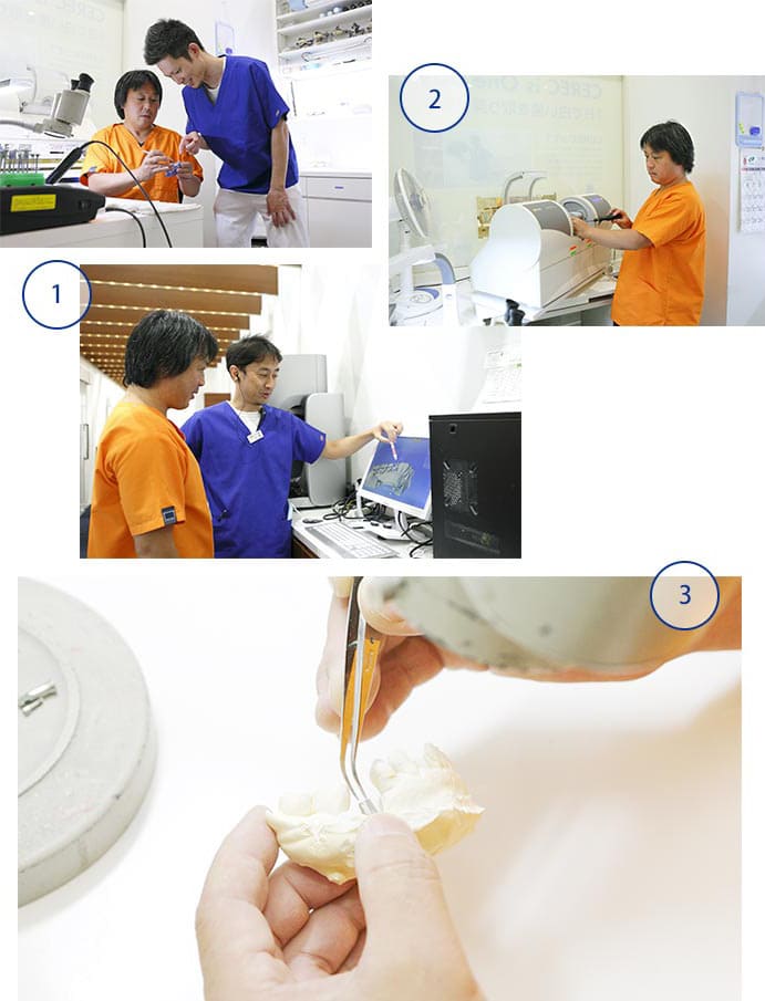 江東区東雲、豊洲の歯医者のキャナルコート歯科クリニック　院内に技工所を併設することでスピーディーかつ完成度の高い技工物を提供しています