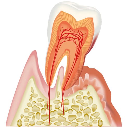 江東区東雲、豊洲の歯医者のキャナルコート歯科クリニック　歯周病治療歯周治療は全ての土台